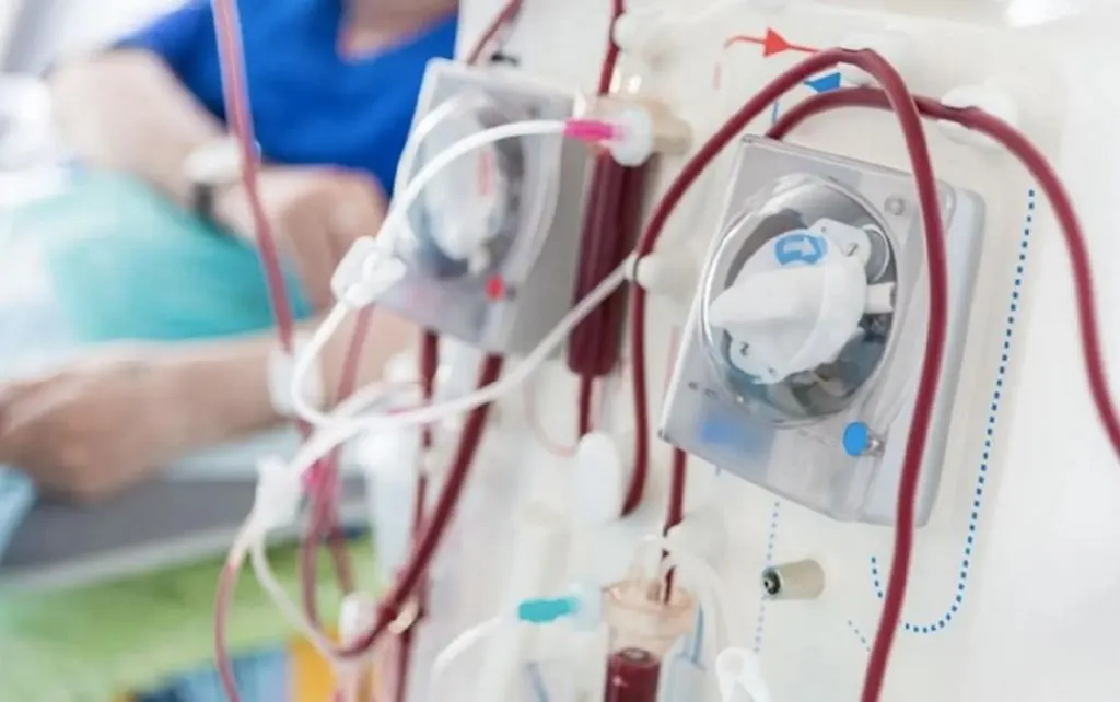 En Argentina, hay 30.000 pacientes en diálisis crónica