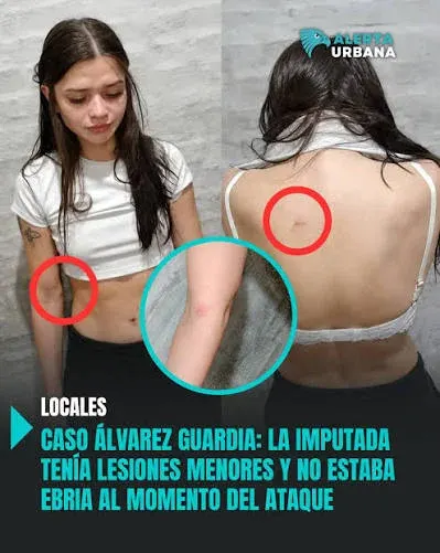 Excoriaciones y eritema: qué dijo el médico que examinó a la joven que asesinó a su novio tras una discusión en Chaco