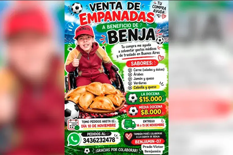 Comenzó la venta de empanadas para costear el viaje de Benjamín Prado a su próximo control médico