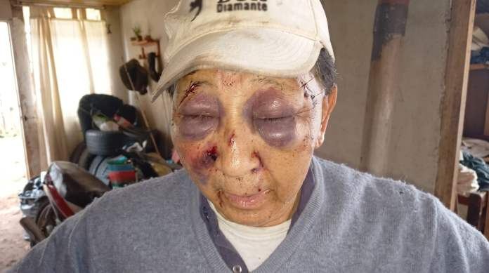 Murió el hombre que había sido golpeado durante un asalto a su vivienda