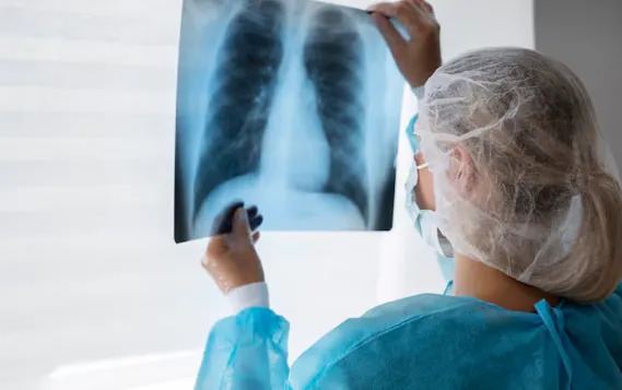 Peste neumónica: especialistas del Clínicas explican qué es y cuál es el riesgo para Argentina