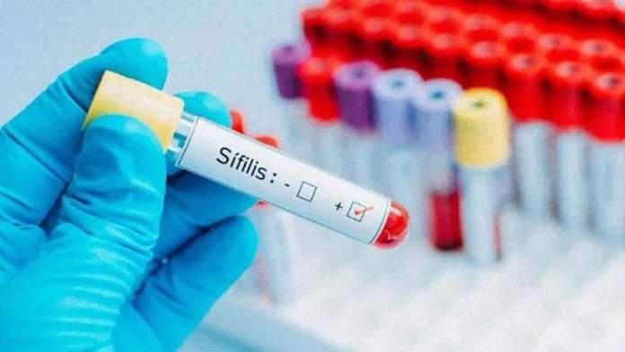 Proponen crear un programa provincial de prevención de sífilis