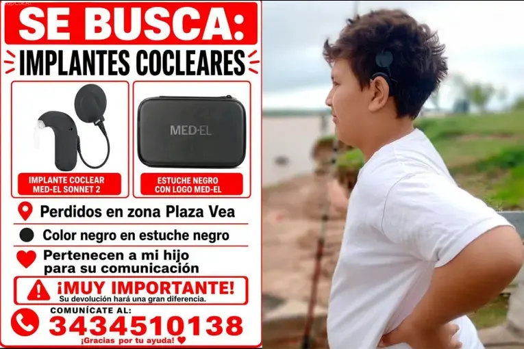 Un niño perdió los implantes que necesita para oír, engañaron a su madre al intentar recuperarlos y piden ayuda
