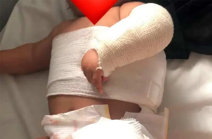 Una mujer le arrojó agua caliente a un bebé en Concordia